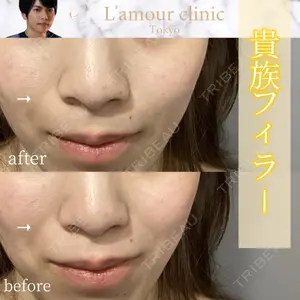 L‘amour clinic Tokyo【ラムールクリニック東京】 片岡 紘士医師の症例