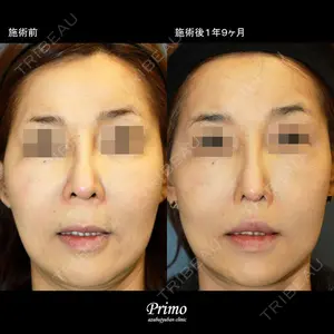 プリモ麻布十番クリニック 大場教弘医師の症例