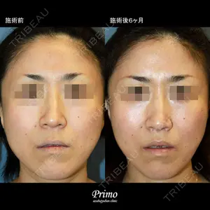 プリモ麻布十番クリニック 大場教弘医師の症例