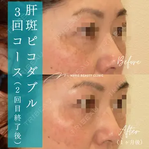 Mavie Beauty Clinic （マヴィービューティークリニック）の症例