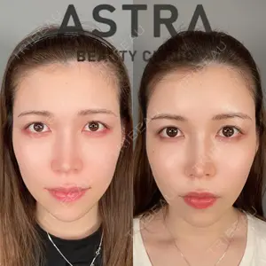 ASTRA BEAUTY CLINICの症例