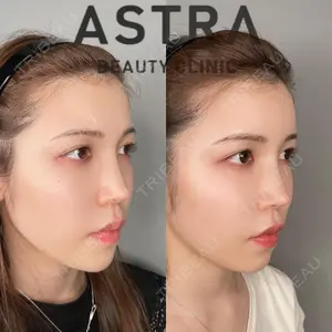 ASTRA BEAUTY CLINICの症例