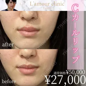 L‘amour clinic Tokyo【ラムールクリニック東京】 片岡 紘士医師の症例