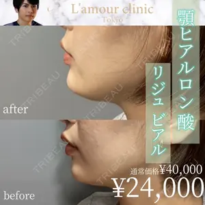 L‘amour clinic Tokyo【ラムールクリニック東京】 片岡 紘士医師の症例