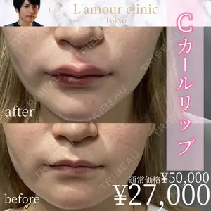 L‘amour clinic Tokyo【ラムールクリニック東京】 片岡 紘士医師の症例