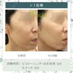 オラクル美容皮膚科 東京新宿院の症例