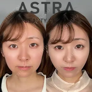 ASTRA BEAUTY CLINIC 塩満 惠子医師の症例