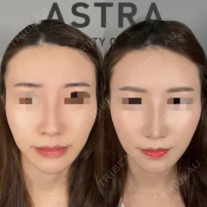 ASTRA BEAUTY CLINIC 塩満 惠子医師の症例