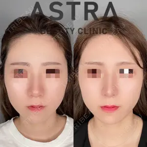 ASTRA BEAUTY CLINIC 塩満 惠子医師の症例