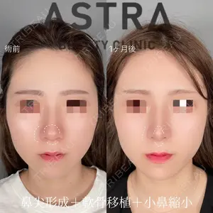 ASTRA BEAUTY CLINIC 塩満 惠子医師の症例