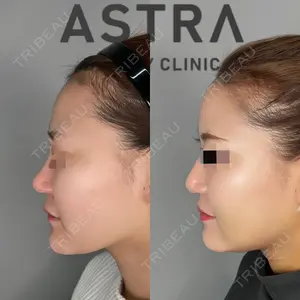 ASTRA BEAUTY CLINIC 塩満 惠子医師の症例