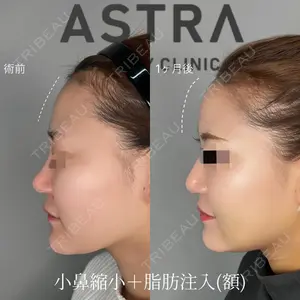 ASTRA BEAUTY CLINIC 塩満 惠子医師の症例