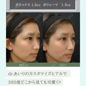 美容皮膚科エルムクリニック 京都院の症例