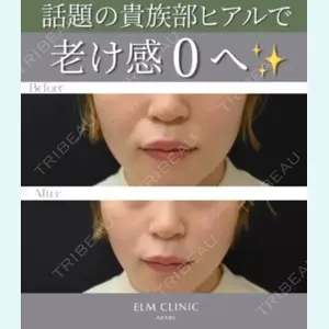 美容皮膚科エルムクリニック 麻布院 横山 歩依里医師の症例