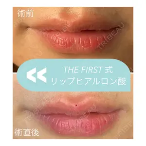 THE FIRST CLINIC 多摩センター院 惟村 公郁医師の症例