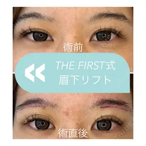 THE FIRST CLINIC 多摩センター院 惟村 公郁医師の症例