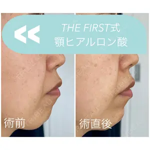 THE FIRST CLINIC 多摩センター院 惟村 公郁医師の症例