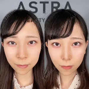 ASTRA BEAUTY CLINIC 塩満 惠子医師の症例