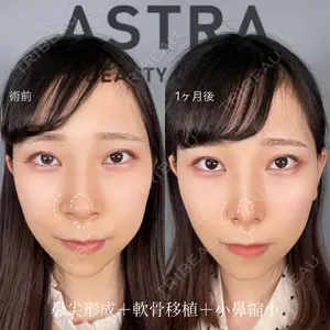 ASTRA BEAUTY CLINIC 塩満 惠子医師の症例