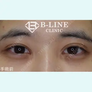 B-LINE CLINIC 池袋院 小池 康弘医師の症例