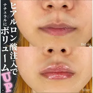 ルラ美容クリニック 千葉院 / ルラスキンクリニック 千葉院 下川 洋輝医師の症例