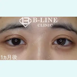 B-LINE CLINIC 池袋院 小池 康弘医師の症例