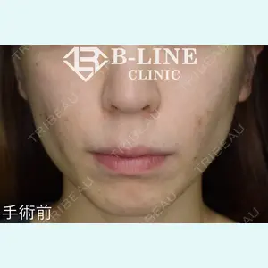 B-LINE CLINIC 池袋院 小池 康弘医師の症例