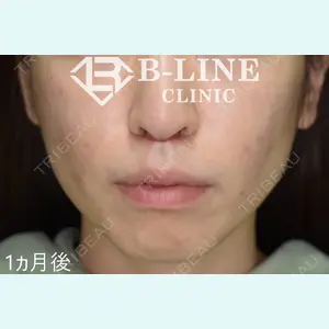 B-LINE CLINIC 池袋院 小池 康弘医師の症例