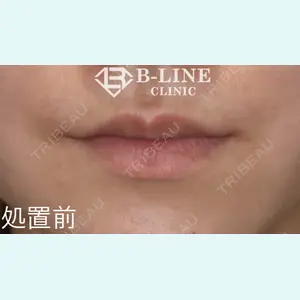 B-LINE CLINIC 池袋院 小池 康弘医師の症例