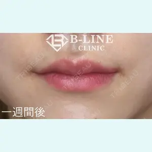 B-LINE CLINIC 池袋院 小池 康弘医師の症例