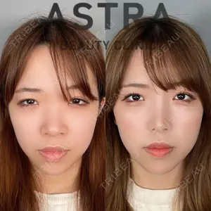 ASTRA BEAUTY CLINIC 塩満 惠子医師の症例