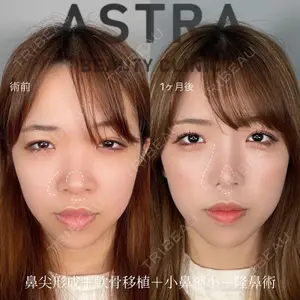 ASTRA BEAUTY CLINIC 塩満 惠子医師の症例