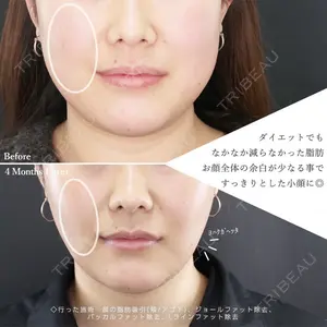 札幌TAクリニック 香山 武蔵医師の症例