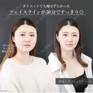 新宿TAクリニック 奥津 綾夏医師の症例