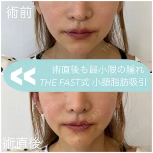 THE FIRST CLINIC 多摩センター院 惟村 公郁医師の症例