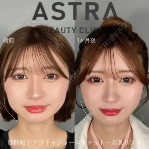 ASTRA BEAUTY CLINICの症例