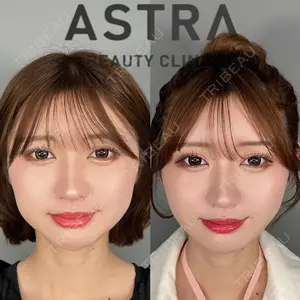 ASTRA BEAUTY CLINICの症例