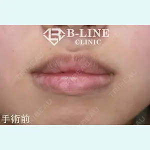 B-LINE CLINIC 池袋院 小池 康弘医師の症例