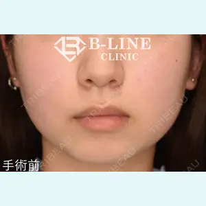 B-LINE CLINIC 池袋院 小池 康弘医師の症例