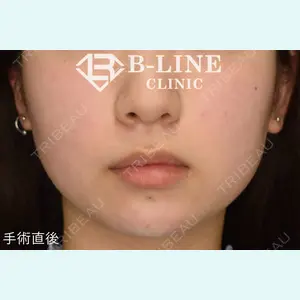 B-LINE CLINIC 池袋院 小池 康弘医師の症例