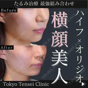 Tokyo Tensei Clinic 新宿院 沖津 勇気（ブレイブ沖津）医師の症例