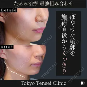 Tokyo Tensei Clinic 新宿院 沖津 勇気（ブレイブ沖津）医師の症例