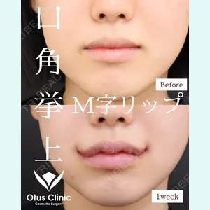 Otus Clinic 【オータスクリニック】 中 徳太郎医師の症例