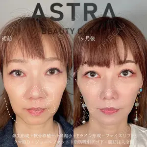 ASTRA BEAUTY CLINIC 塩満 惠子医師の症例