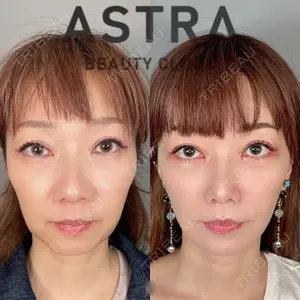 ASTRA BEAUTY CLINIC 塩満 惠子医師の症例