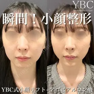 YBC横浜美容外科 大宮院 磯村 亮輔医師の症例