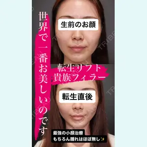 Tokyo Tensei Clinic 新宿院 沖津 勇気（ブレイブ沖津）医師の症例