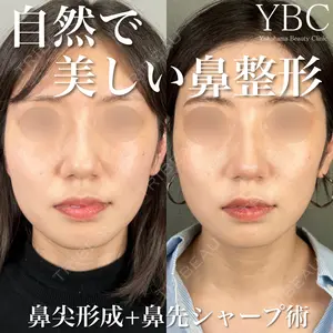 YBC横浜美容外科 大宮院 磯村 亮輔医師の症例