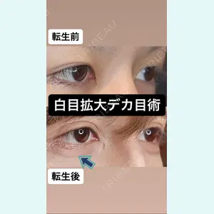 Tokyo Tensei Clinic 新宿院 沖津 勇気（ブレイブ沖津）医師の症例