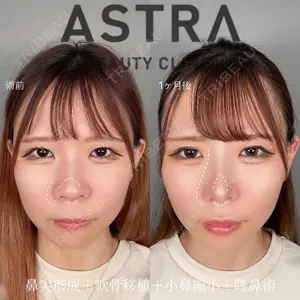 ASTRA BEAUTY CLINIC 塩満 惠子医師の症例